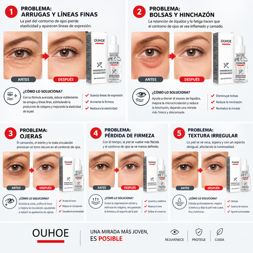 Serum quita Ojeras